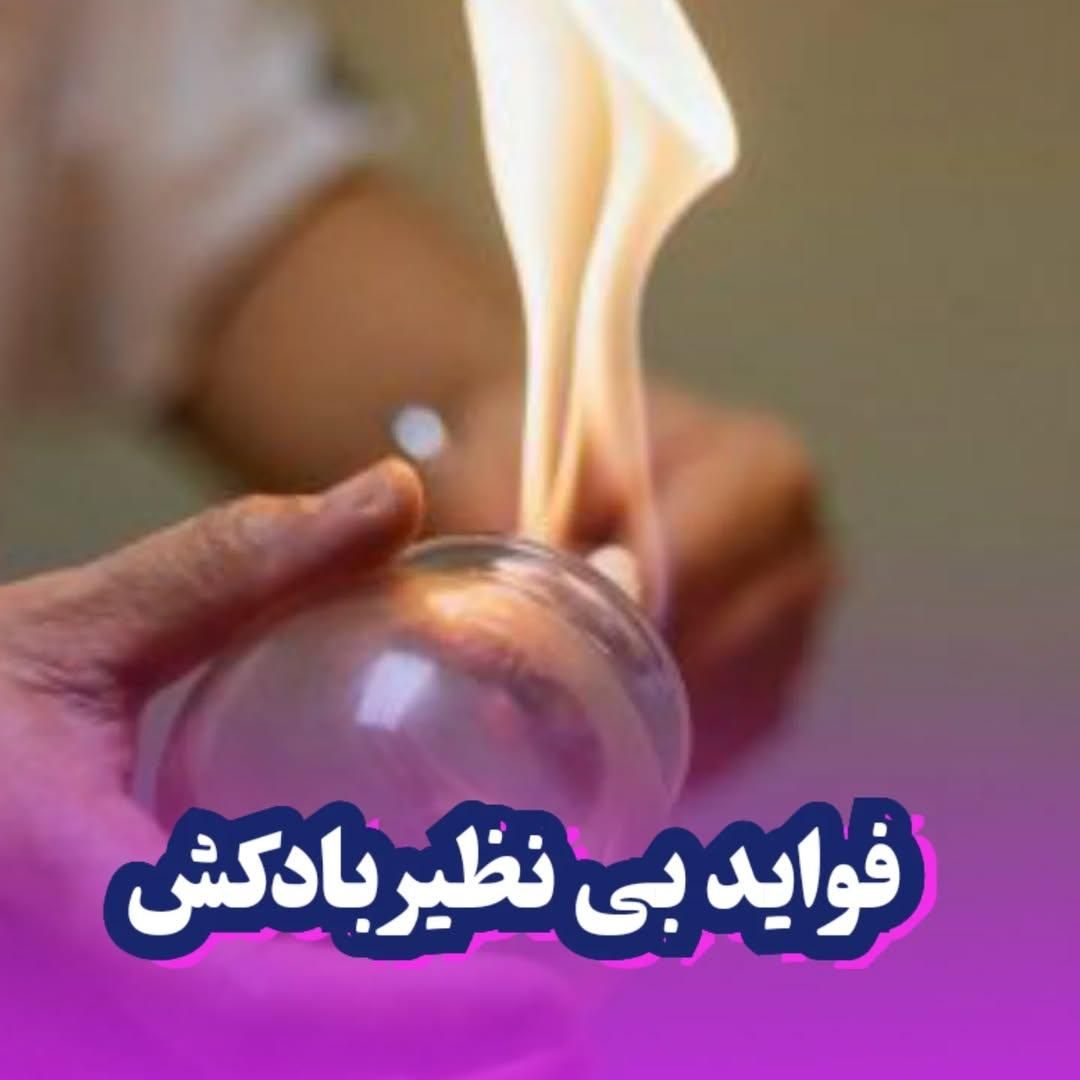 امبدینگ موکساتراپی حجامت طب سوزنی بادکش فصد زگیل|خدمات آرایشگری و زیبایی|اصفهان, مسجد مصلی|دیوار