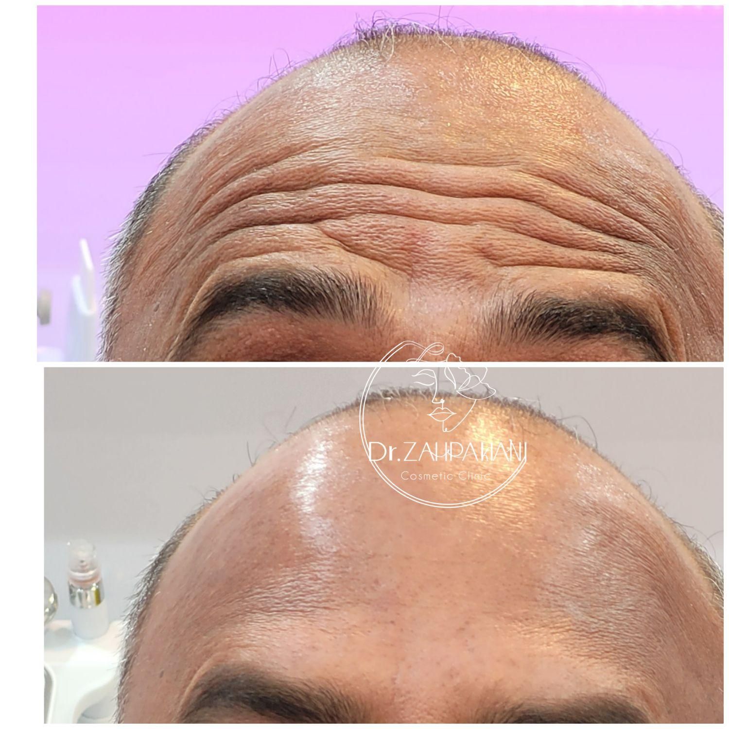 مرکز لیزر و زیبایی دکتر کیانی/ ژل بوتاکس مزو|خدمات آرایشگری و زیبایی|اهواز, کوروش|دیوار