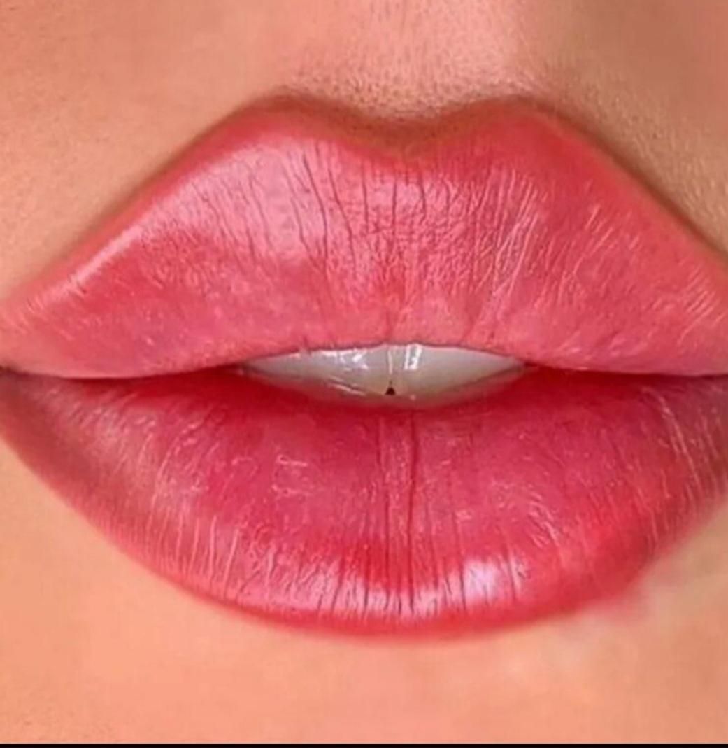 تخفیف لیزرمو،تزریق ژل لب بوتاکس هایفو لیفت صورت نخ|خدمات آرایشگری و زیبایی|تهران, ستارخان|دیوار