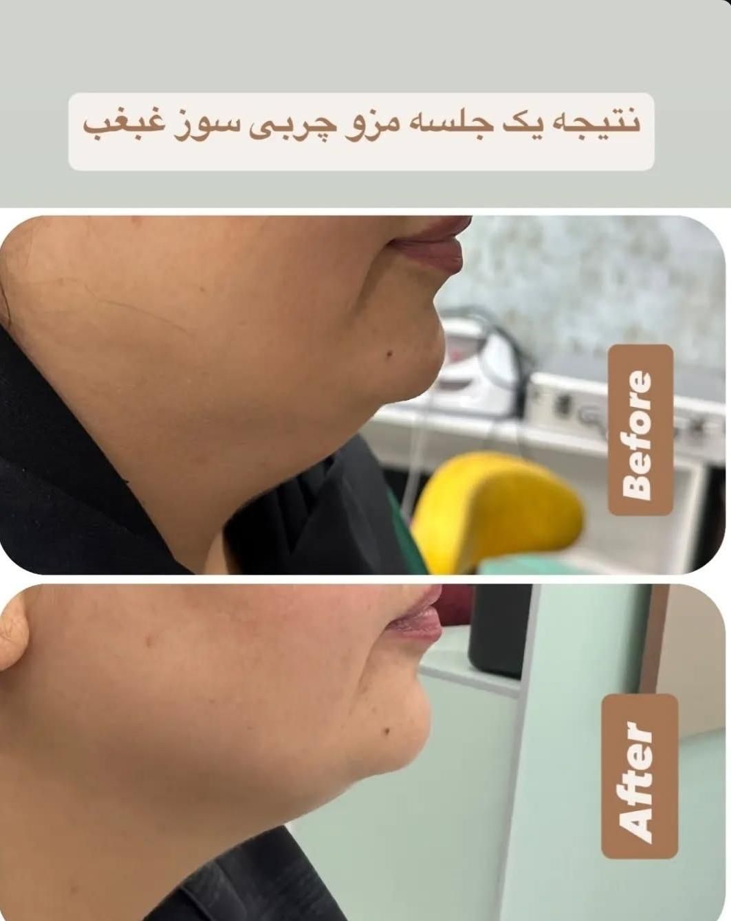 درمان تخصصی ریزش و قطع ریزش مو در کلینیک تخصصی|خدمات آرایشگری و زیبایی|برازجان, |دیوار