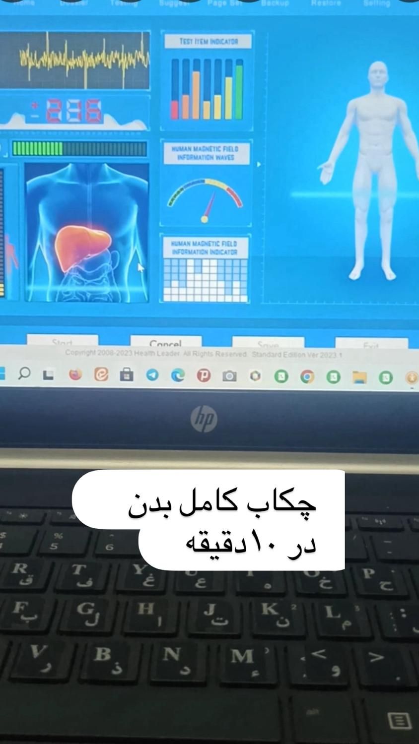چکاب.حجامت.زالو.سم زدایی.جاانداختن رگ|خدمات آرایشگری و زیبایی|بم, |دیوار
