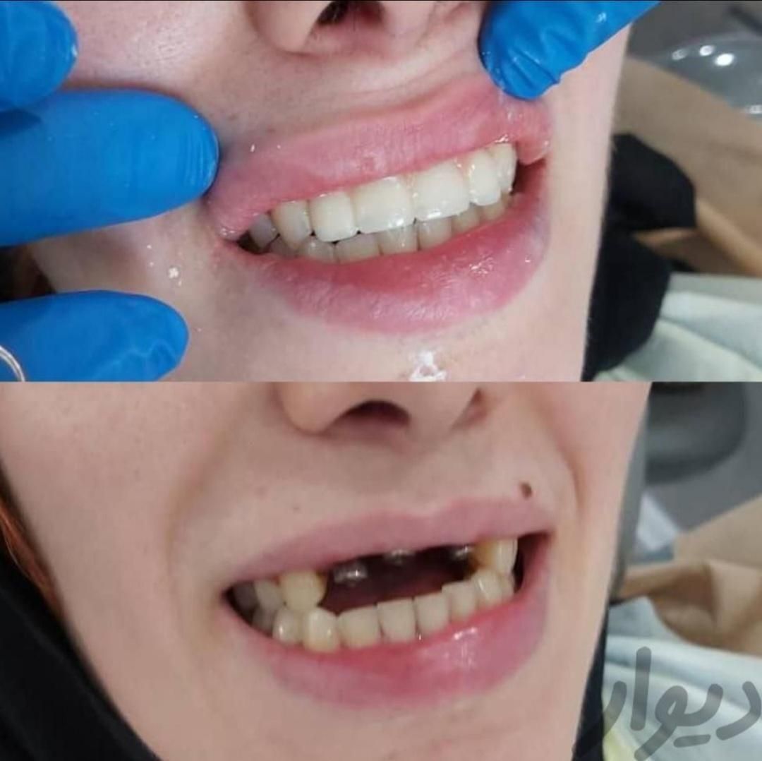 کلینیک تخصصی دندانپزشکی و ایمپلنت  در سیرجان|خدمات آرایشگری و زیبایی|سیرجان, |دیوار