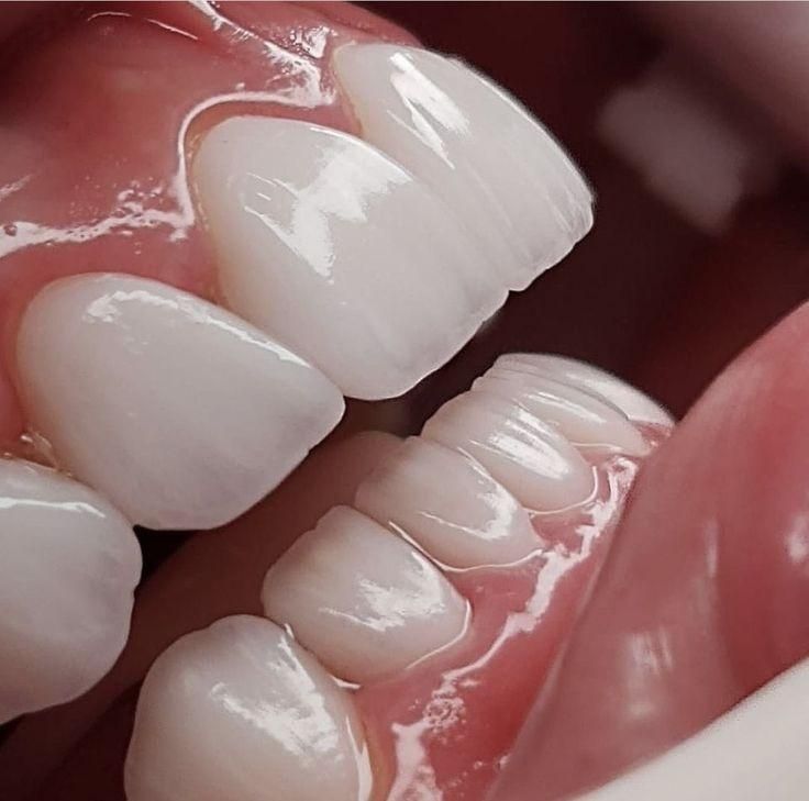 خدمات تخصصی ترمیم دندان|خدمات آرایشگری و زیبایی|رباط‌کریم, |دیوار