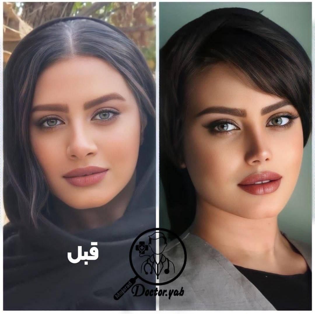 جراحی بینی در شیراز/نوبتگیری +وام+مشاوره|خدمات آرایشگری و زیبایی|جهرم, |دیوار