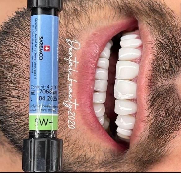 دندانپزشکی نقدواقساط باتخفیفات بینظیر فقط بمدت۷روز|خدمات آرایشگری و زیبایی|شیراز, ملاصدرا|دیوار