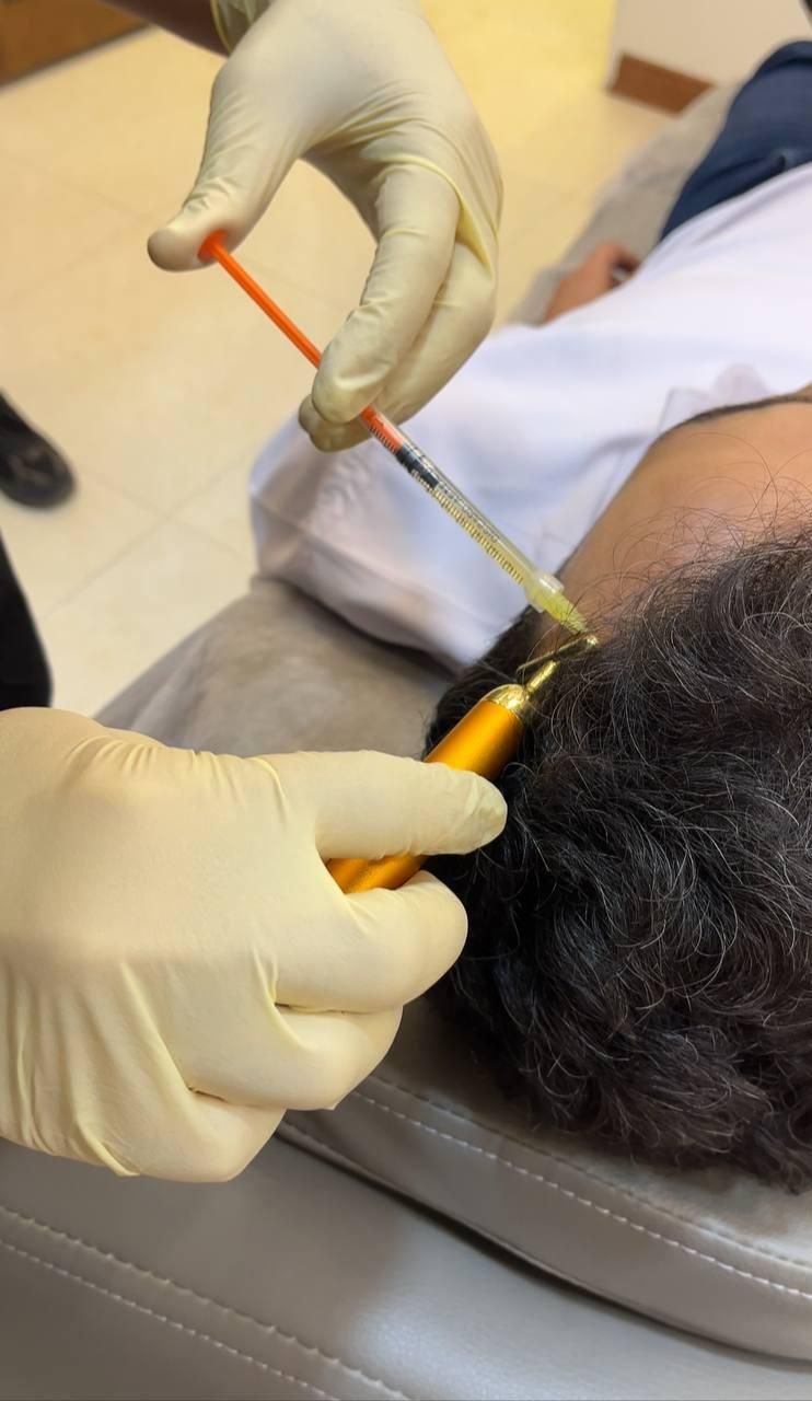 درمان تخصصی ریزش مو در کلینیک زیبایی راویس|خدمات آرایشگری و زیبایی|کاشان, رجایی|دیوار