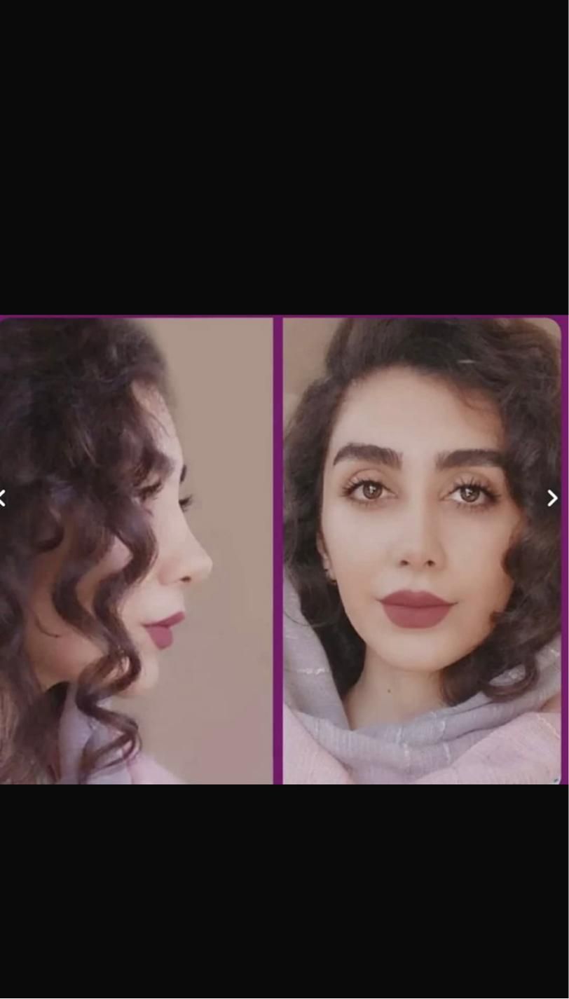 خدمات جراحی زیبایی با شرایط ویژه تابستانی|خدمات آرایشگری و زیبایی|تهران, مهران (سیدخندان)|دیوار