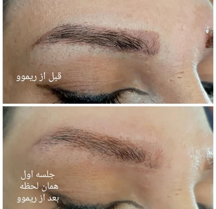 خدمات تتوصورت بدن میکروابرو ریمو شیدلب چشم|خدمات آرایشگری و زیبایی|تهران, هفت حوض|دیوار