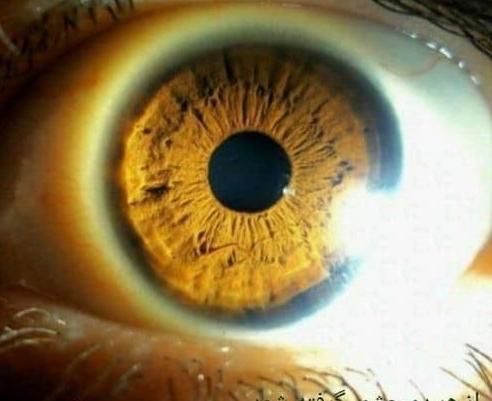 حجامت.زالودرمانی.طب سوزنی.چاقی.لاغری|خدمات آرایشگری و زیبایی|مشهد, رسالت|دیوار