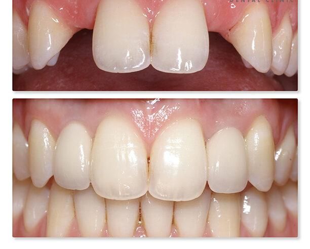 کلینیک تخصصی روکش و روکش ایمپلنت با تضمین کیفیت|خدمات آرایشگری و زیبایی|تبریز, |دیوار