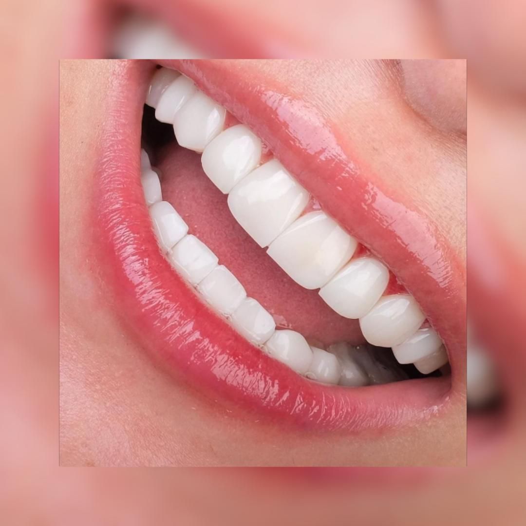 جشنواره یک روزه کامپوزیت در تهران|خدمات آرایشگری و زیبایی|پاکدشت, شهرک امام رضا|دیوار