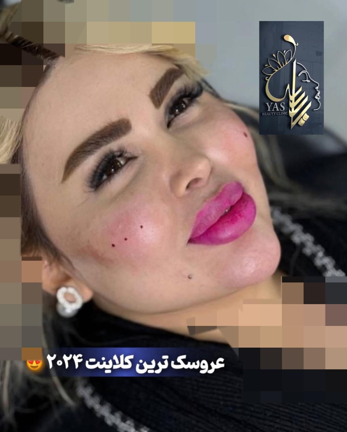 تزریق ژل وبوتاکس ومادلینگ اروپایی وهایفو درکلینیک|خدمات آرایشگری و زیبایی|کرمانشاه, |دیوار