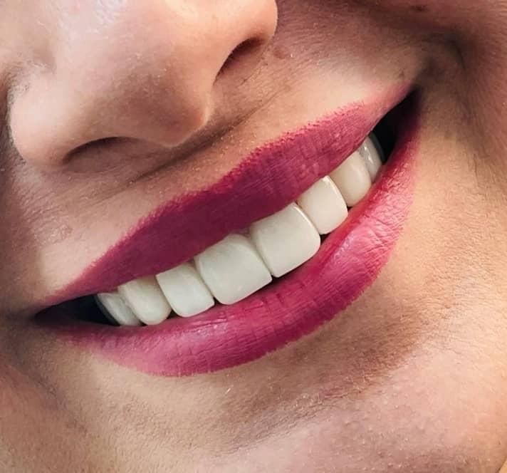 دندانسازی|خدمات آرایشگری و زیبایی|شیراز, زند|دیوار