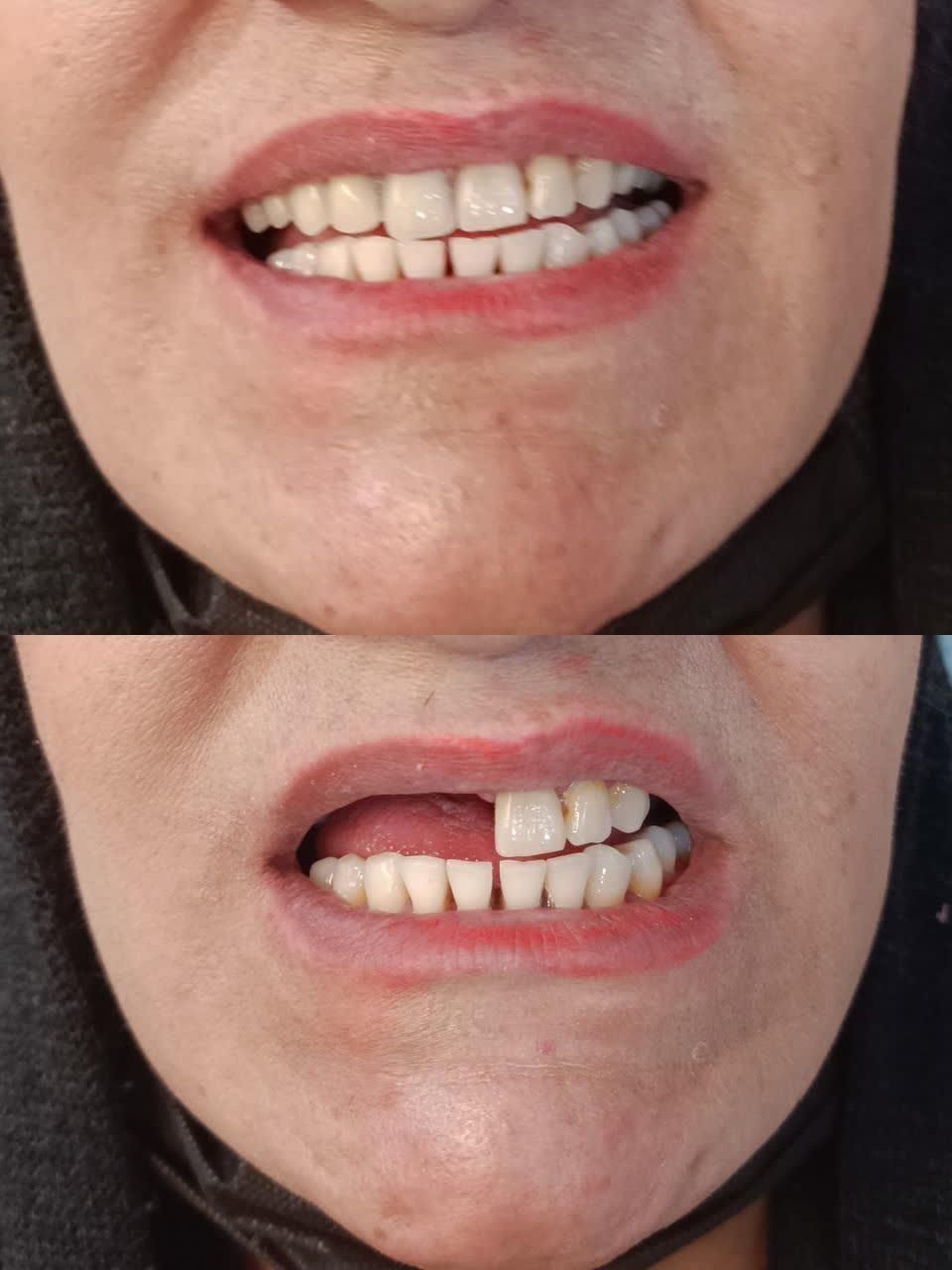 خدمات دندان مصنوعی|خدمات آرایشگری و زیبایی|اصفهان, ارداجی|دیوار