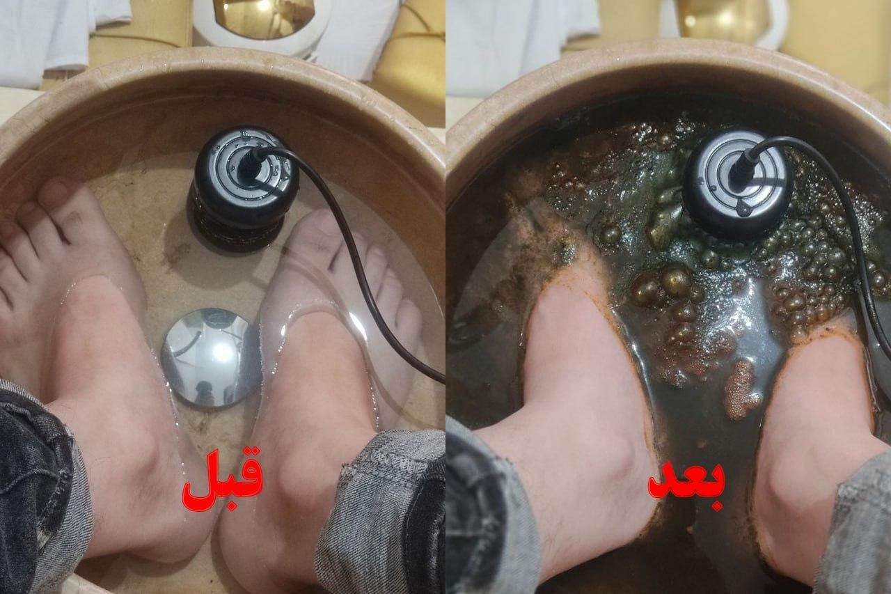 سم‌زدایی با دستگاه یون‌تراپی مخصوص بانوان|خدمات آرایشگری و زیبایی|تهران, دبستان|دیوار