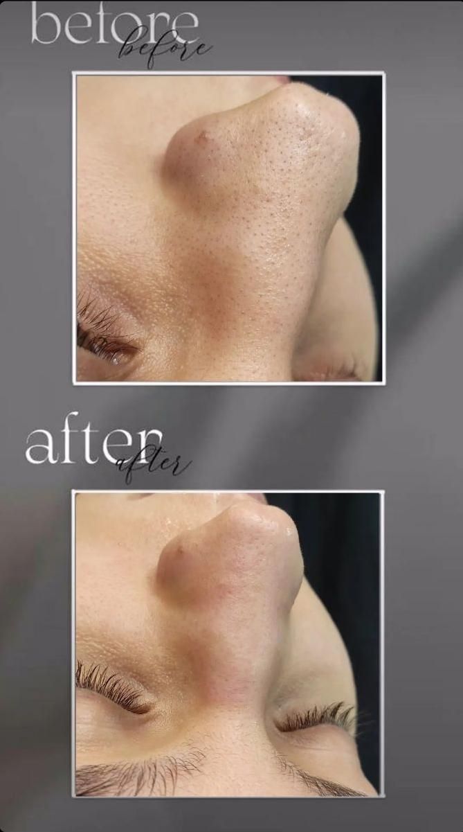 مدل پاکسازی و فیشال پوست با ۴ سال سابقه کار|خدمات آرایشگری و زیبایی|مشهد, صیاد شیرازی|دیوار