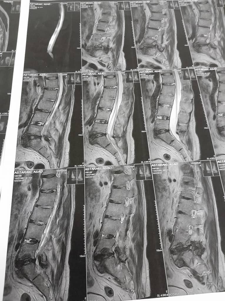 طب فیزیکی سنتی دررفتگی مفاصل دیسک کمر گردن سیاتیک|خدمات آرایشگری و زیبایی|قم, عمار یاسر|دیوار