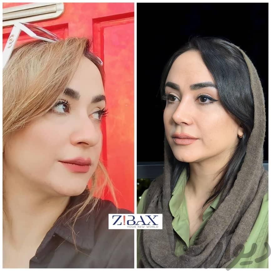 دکتر عمل بینی به سبک طبیعی در شیراز|خدمات آرایشگری و زیبایی|شیراز, فرهنگ شهر|دیوار