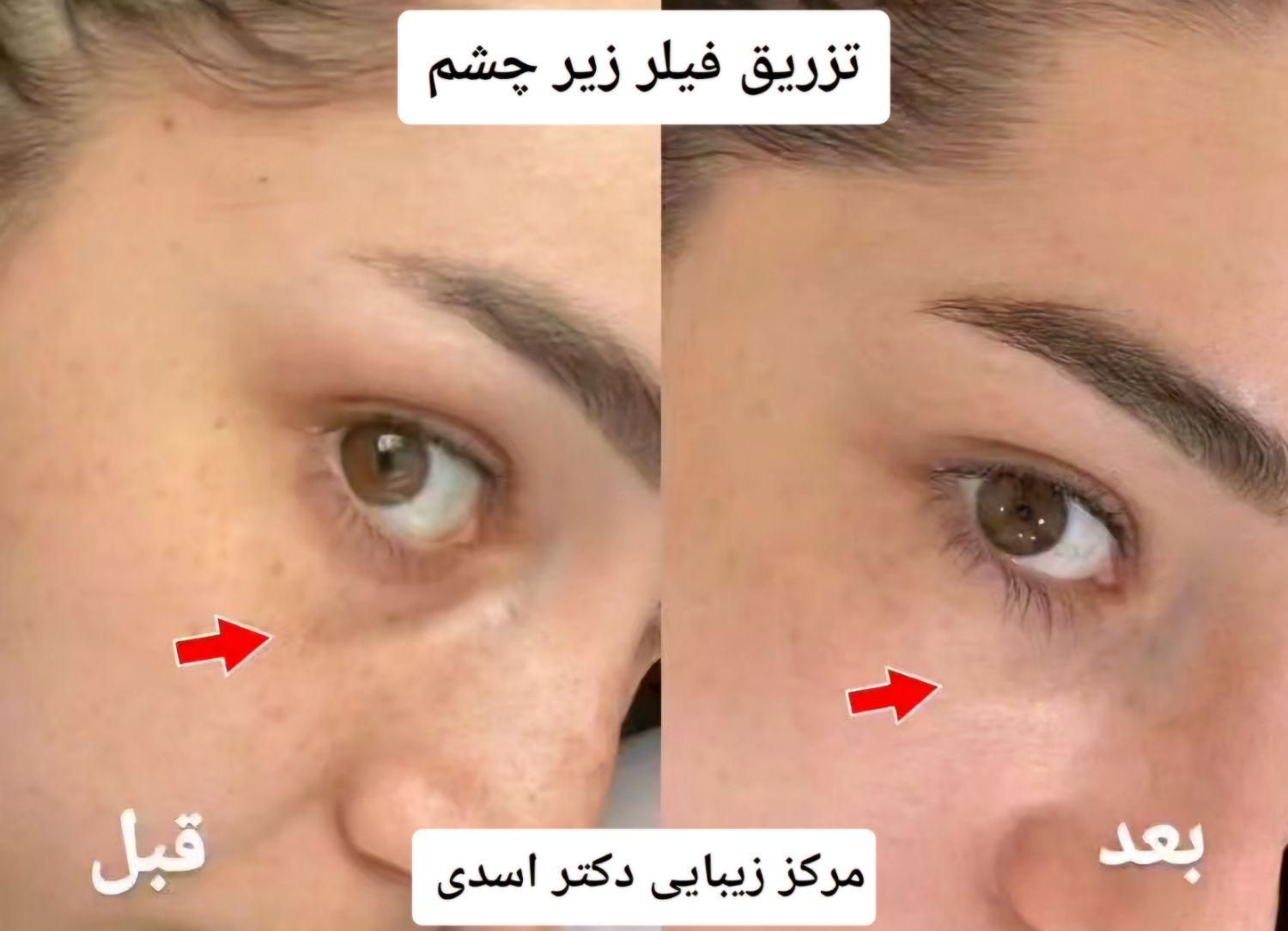 مرکز زیبایی دکتر اسدی (بوتاکس فیلر هایفو مزوتراپی)|خدمات آرایشگری و زیبایی|تهران, نیاوران|دیوار