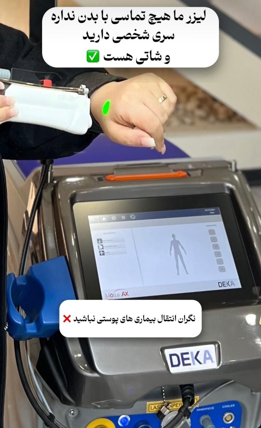 لیزر موهای زائد الکس دکا ۲۰۲۴ بدون تماس با بدن|خدمات آرایشگری و زیبایی|سبزوار, ولیعصر (نجار آباد)|دیوار