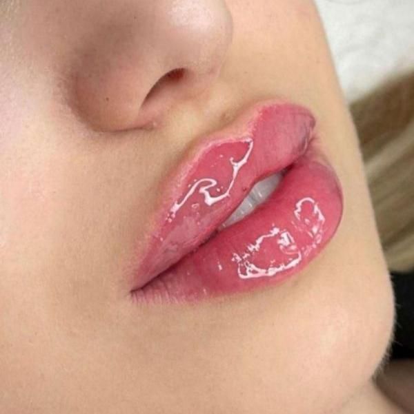 تخفیف ویژه مزو،آنزیم،ژل با بیحسی دندانپزشکی از ۴۰۰|خدمات آرایشگری و زیبایی|گرگان, |دیوار