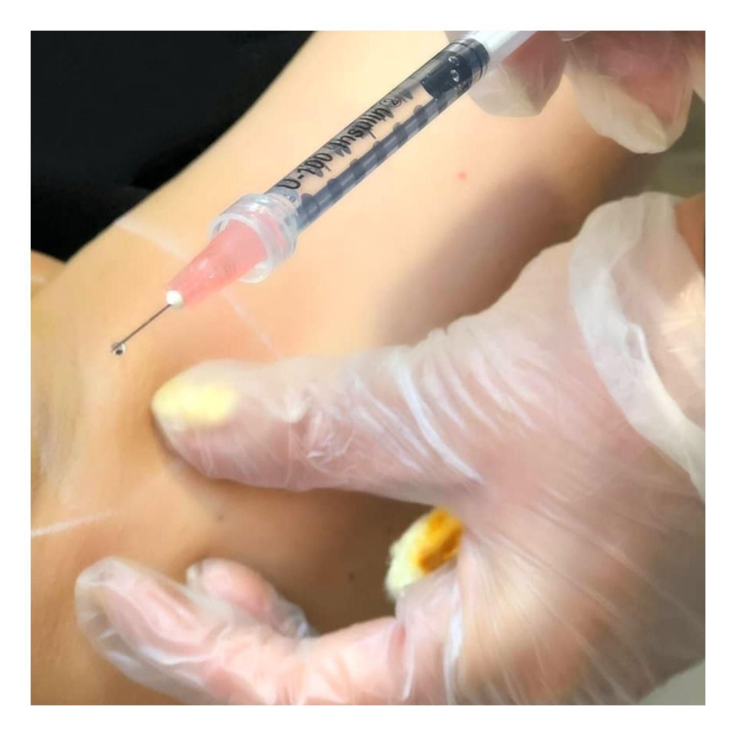 بوتاکس زیربغل/ درمان تعریق|خدمات آرایشگری و زیبایی|شوش, |دیوار