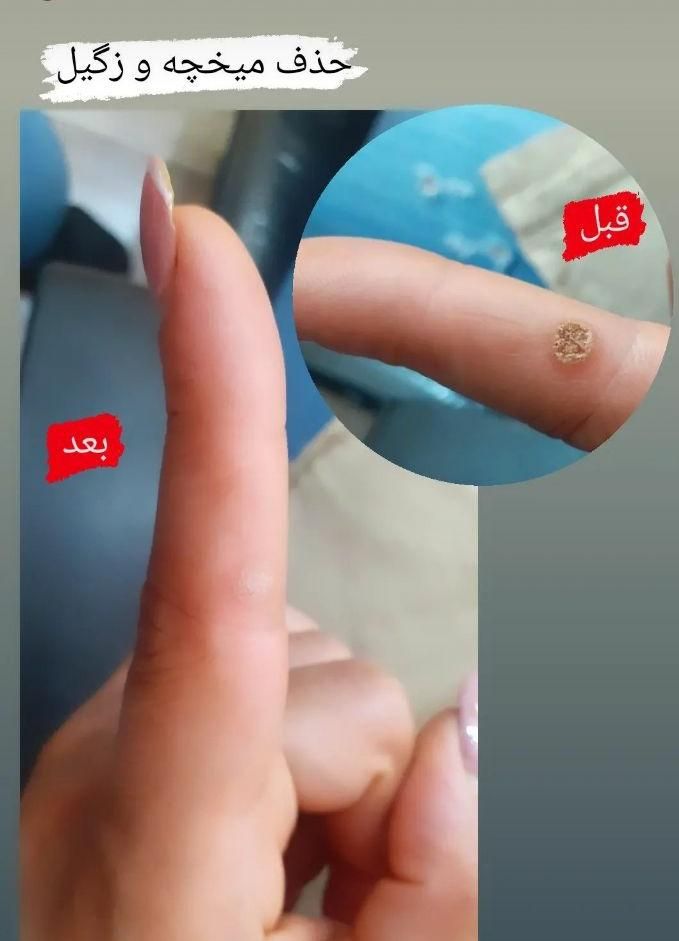 اپیلاسیون دائم،خالبرداری،لیفت ابرو،پارافین تراپی|خدمات آرایشگری و زیبایی|رشت, استقامت 2|دیوار