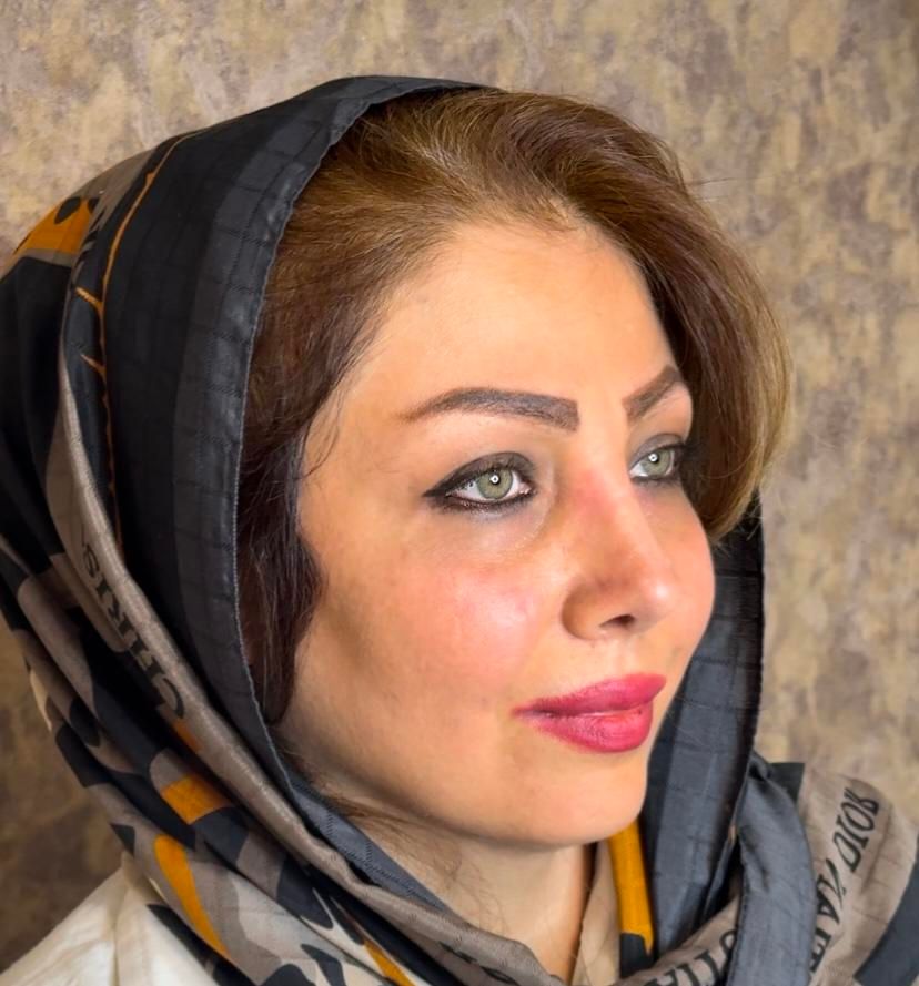 عمل جراحی بینی با بوتاکس رایگان فقط ۲۶،بدون تامپون|خدمات آرایشگری و زیبایی|تهران, یوسف‌آباد|دیوار