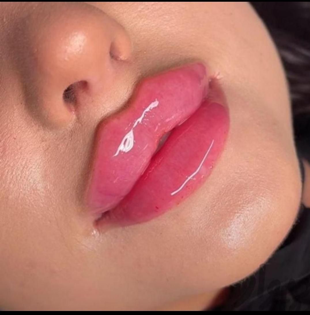 فیلر لب چانه گونه زاویه بوتاکس هایفو ژل مزو لیزر|خدمات آرایشگری و زیبایی|مشهد, فرهنگ|دیوار