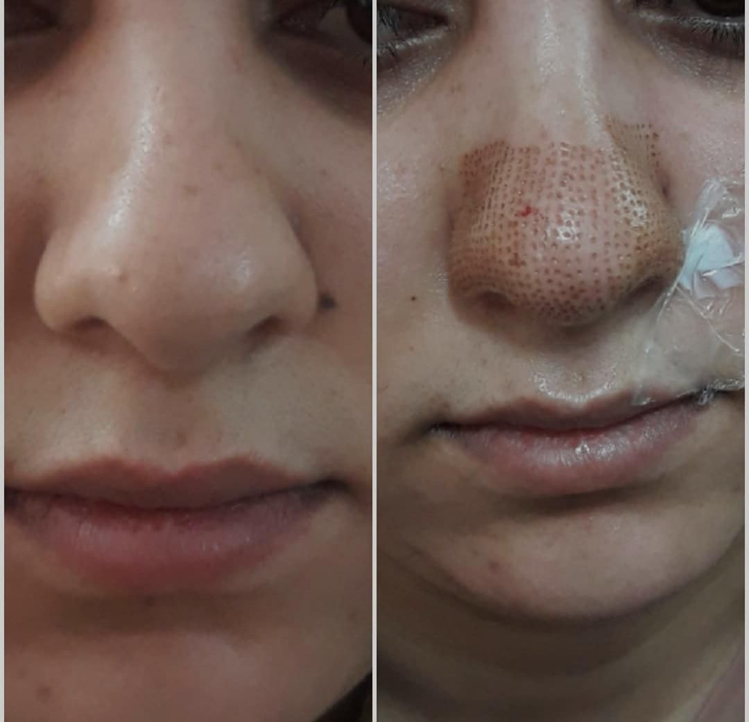 آموزش تاتو فر مو،کاشت مژه.کراتین ناخن+مدرک|خدمات آرایشگری و زیبایی|شیراز, آزادگان|دیوار