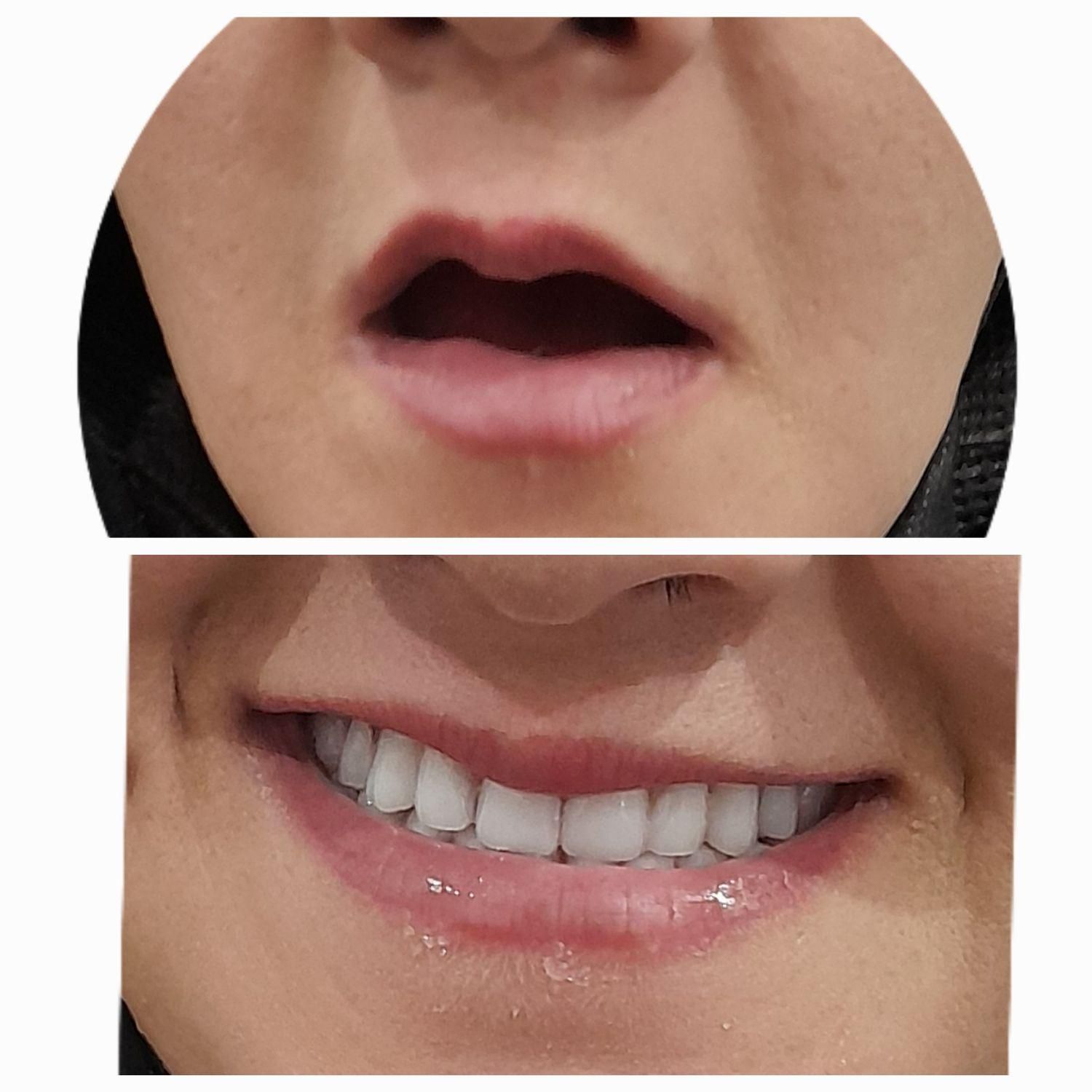 دندان مصنوعی|آرایشی، بهداشتی، درمانی|کاشان, راه آهن کاشان|دیوار