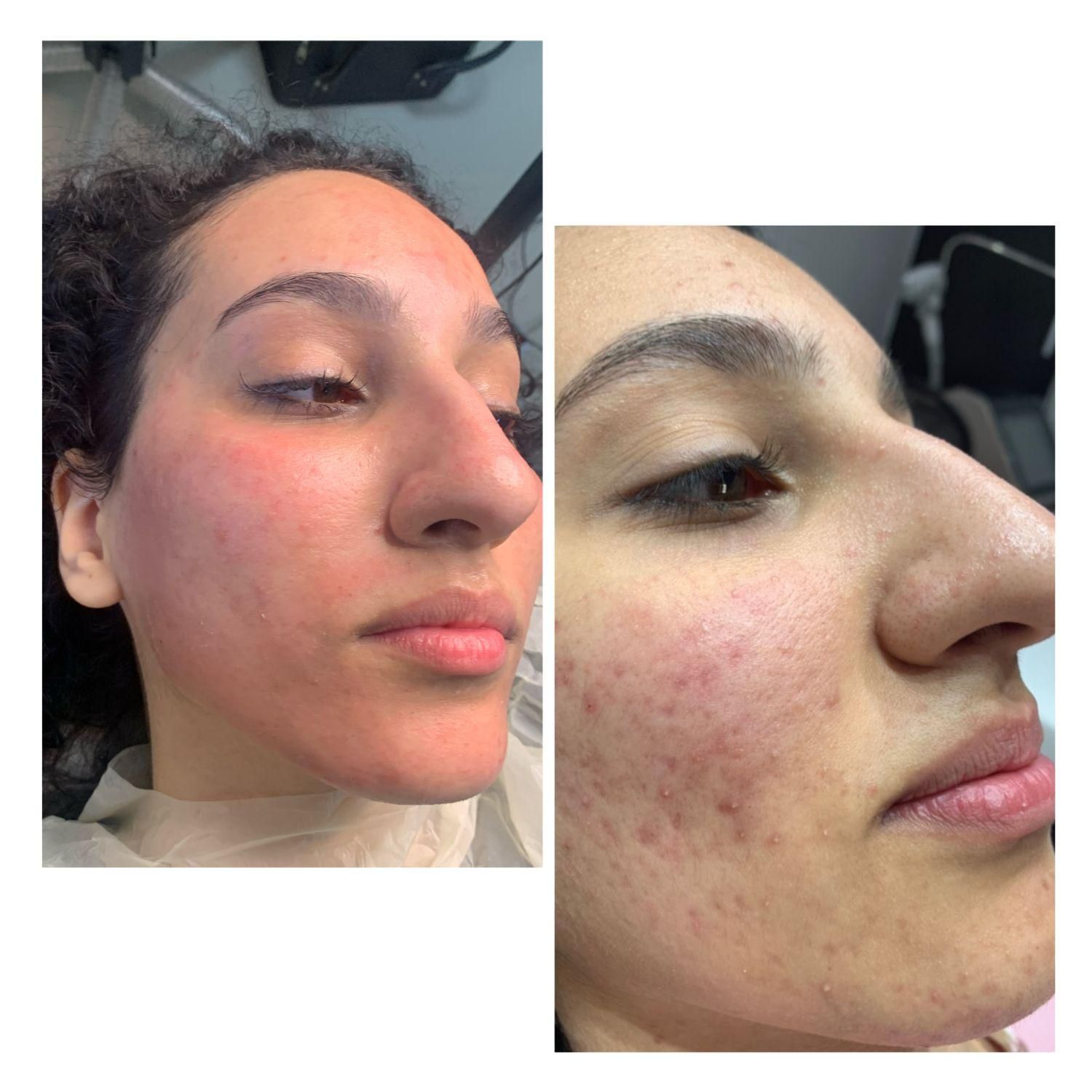 فیشیال و آبرسانی تخصصی/ خدمات و آموزش|خدمات آرایشگری و زیبایی|کرج, فاز ۲ مهرشهر|دیوار