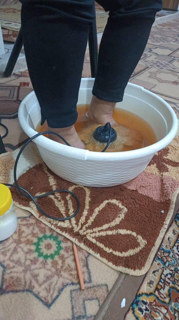 سم زدایی کل بدن با دستگاه|خدمات آرایشگری و زیبایی|زابل, |دیوار