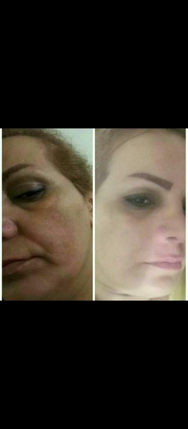 فرمول کرم صورت|آرایشی، بهداشتی، درمانی|مشهد, جلالیه|دیوار