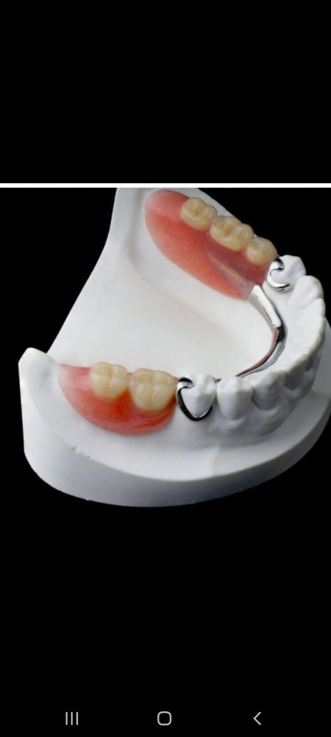 دست دندان طرح لمینیت|خدمات آرایشگری و زیبایی|تهران, مهران (سیدخندان)|دیوار
