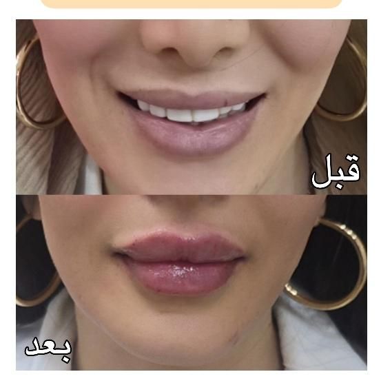 پنجاه درصد تخفیف ژل صورت|خدمات آرایشگری و زیبایی|اهواز, پادادشهر|دیوار