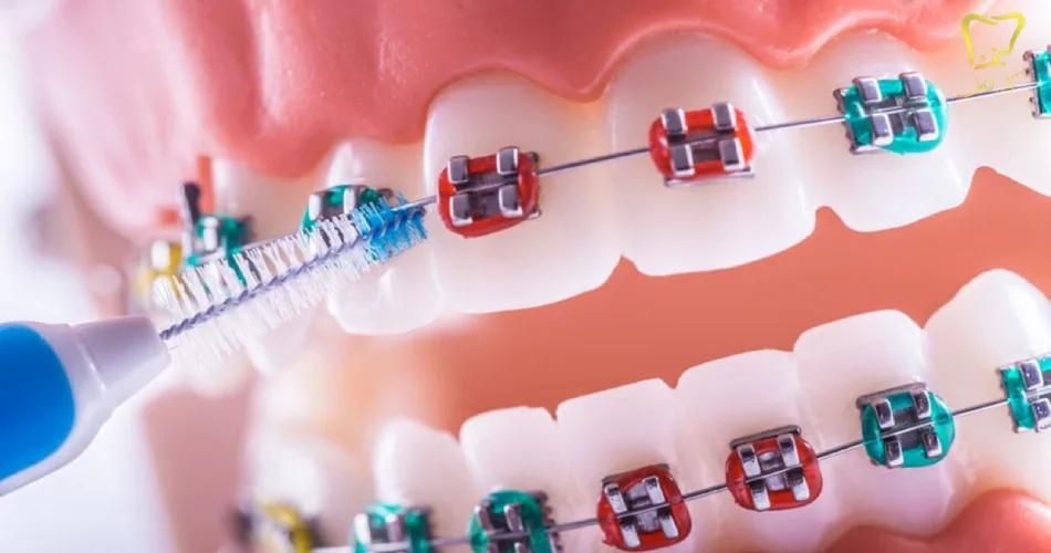 ارتودنسی و ایمپلنت با تخفیف ویژه تابستان|خدمات آرایشگری و زیبایی|یزد, |دیوار