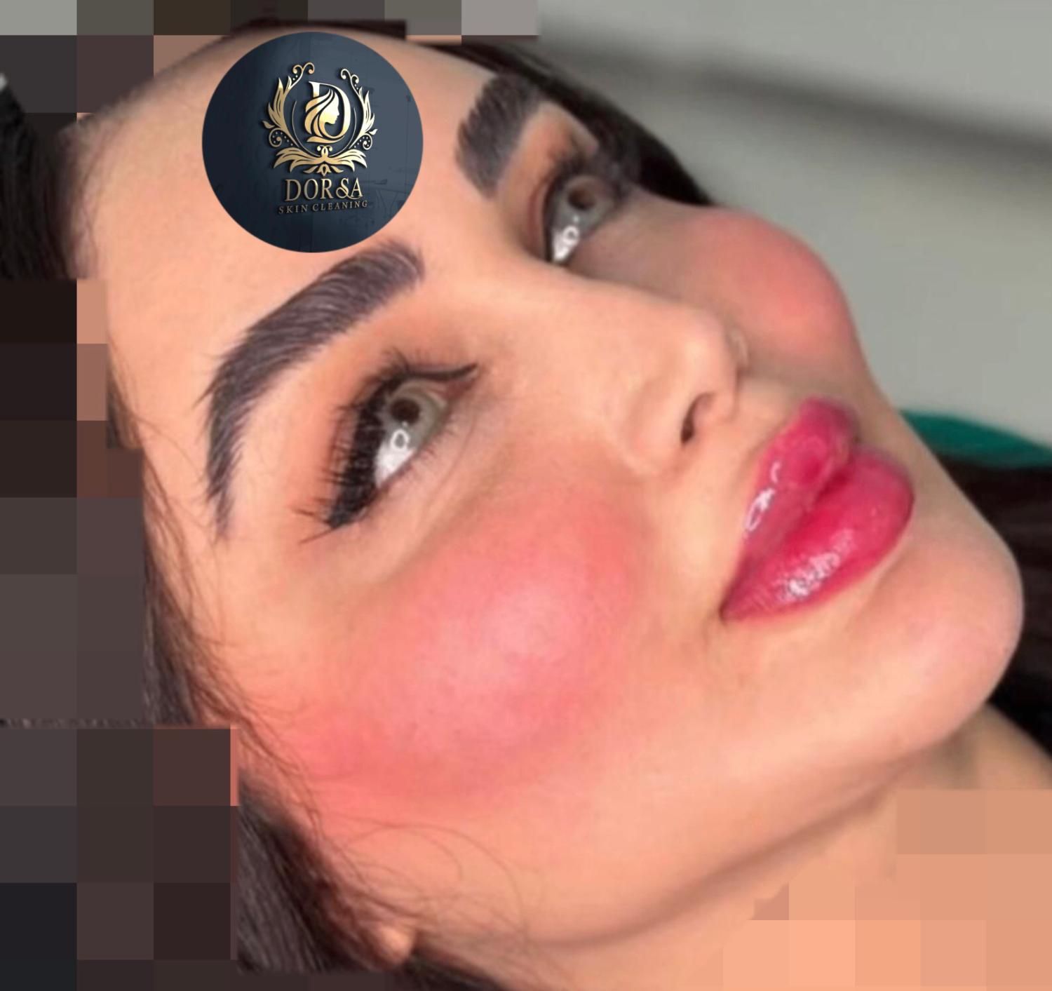 تزریق تخصصی ژل ومادلینگ خلیجی واروپایی وبوتاکس|خدمات آرایشگری و زیبایی|کرمانشاه, |دیوار