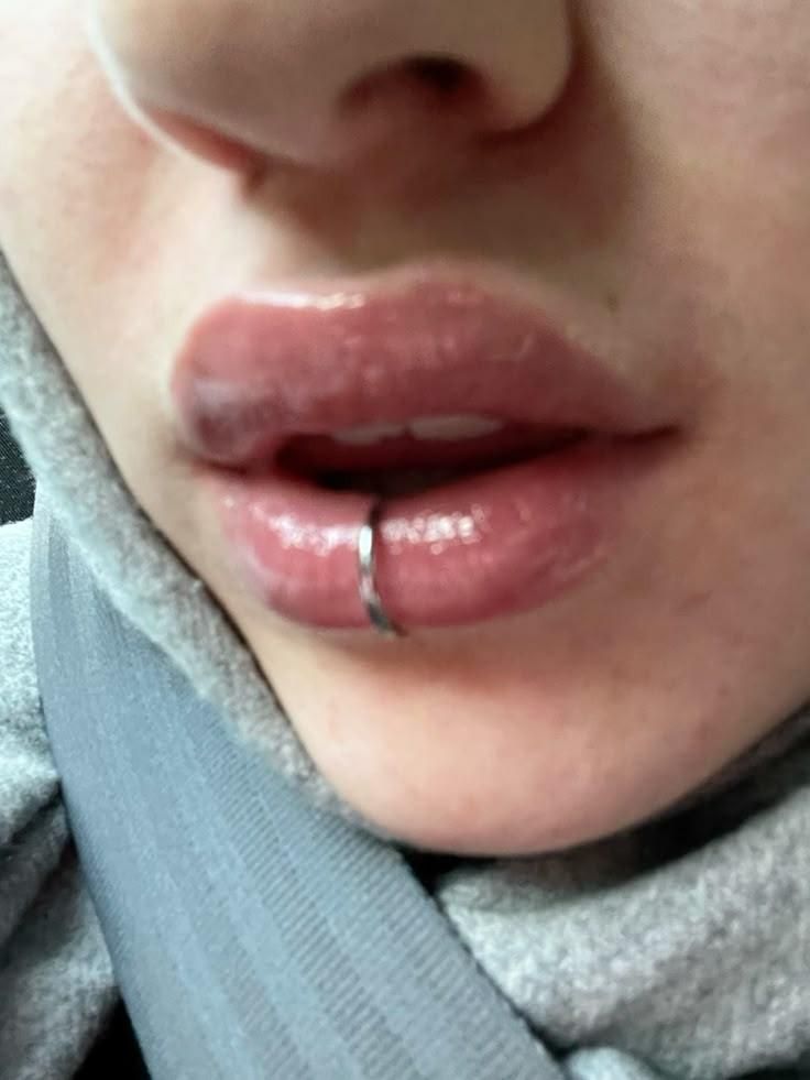 جشنواره فیلر ژل لب چال لپ کاشت نگین دندان پیرسینگ|خدمات آرایشگری و زیبایی|زنجان, |دیوار