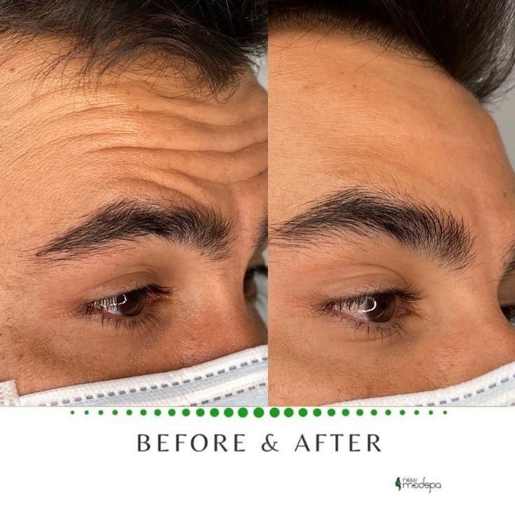 پاکسازی تخصصی پوست آقایان و بانوان|خدمات آرایشگری و زیبایی|گلستان (تهران), |دیوار