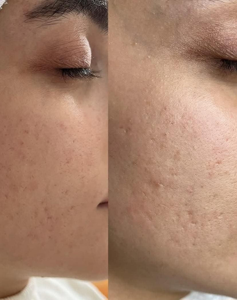 کربوکسی تراپی همراه با فیشال دوتا باهم ۳۵۰|خدمات آرایشگری و زیبایی|دورود, |دیوار