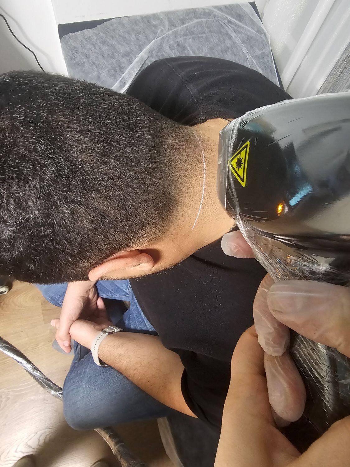 جشنواره لیزر مو های زائد فول بادی ۴۰۰ حتی جمعه ها|خدمات آرایشگری و زیبایی|تهران, تجریش|دیوار