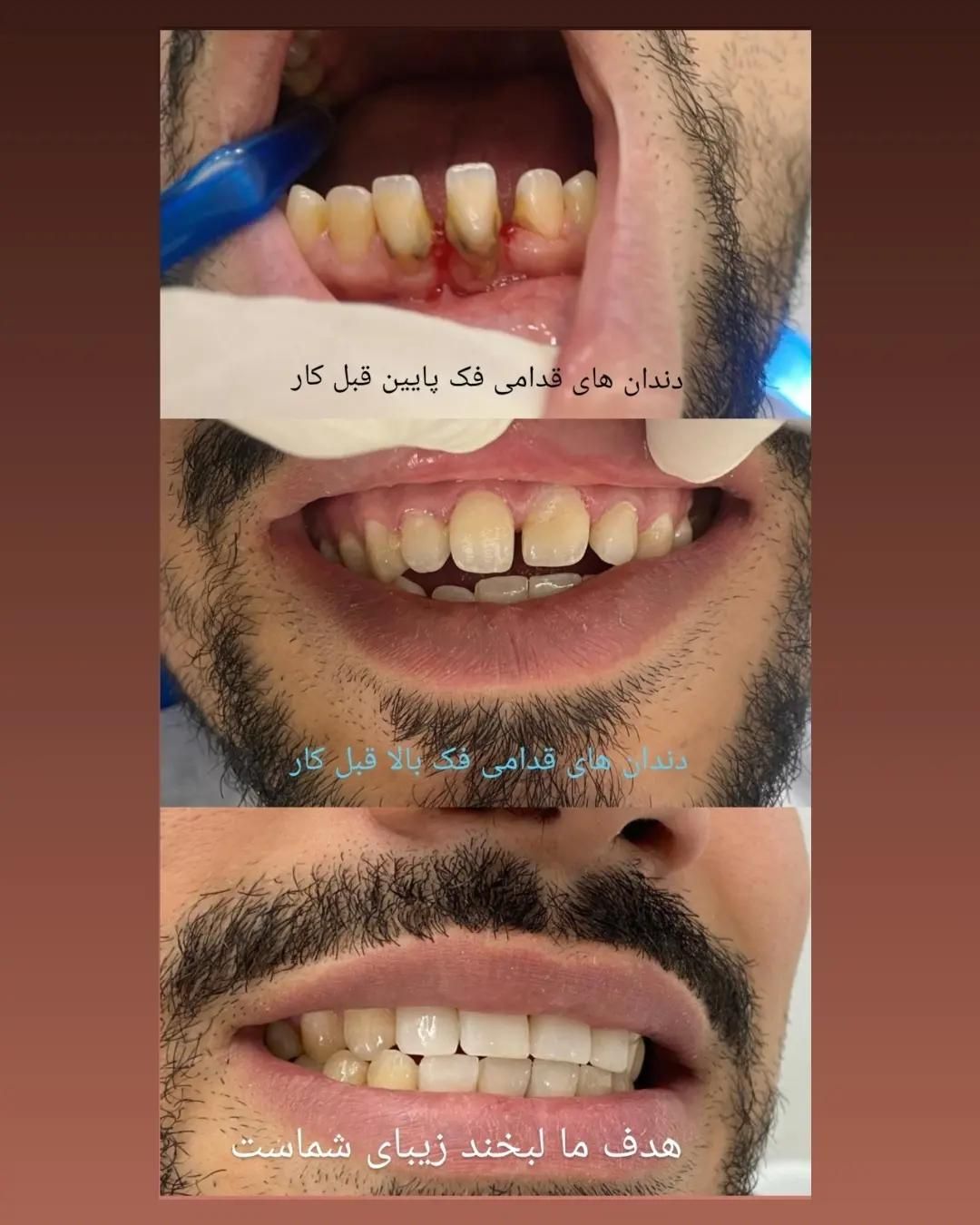 کلینیک تخصصی دندانپزشکی امین|خدمات آرایشگری و زیبایی|مشهد, چهارچشمه|دیوار