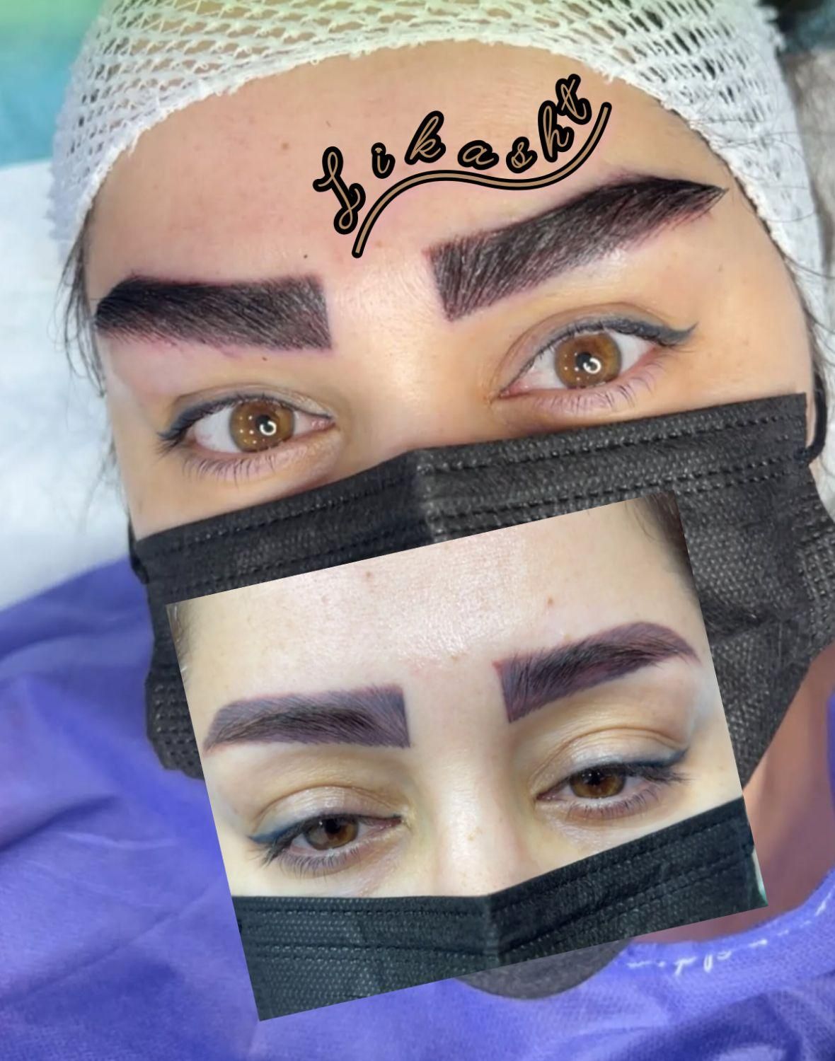 جشنواره ی باورنکردنی کاشت ابرو، کاشت مو، کاشت ریش|خدمات آرایشگری و زیبایی|تهران, نیاوران|دیوار