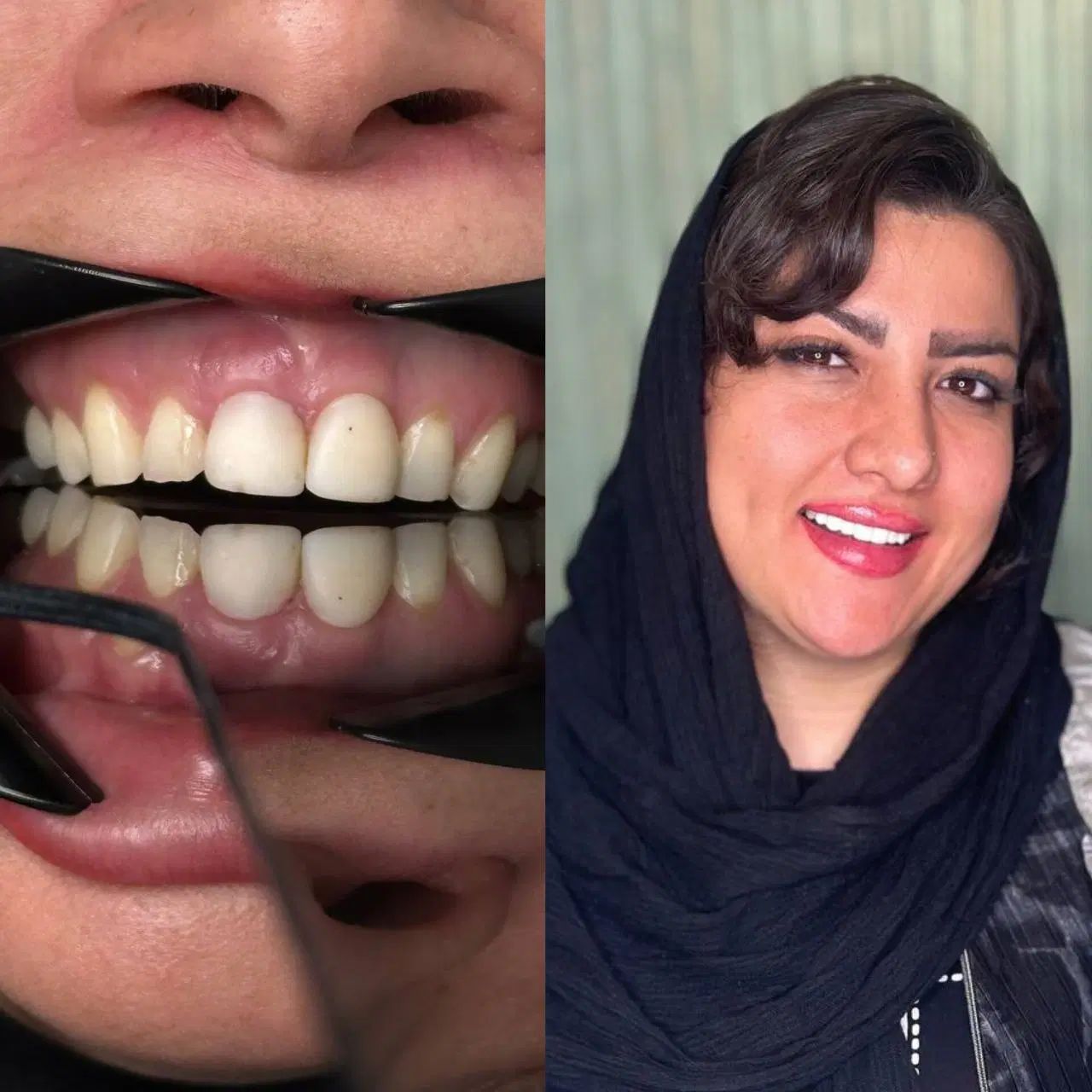 دندان پزشکی اقساطی ۱۲ماهه بدون پیش پرداخت|خدمات آرایشگری و زیبایی|تهران, خانی آباد نو شمالی|دیوار