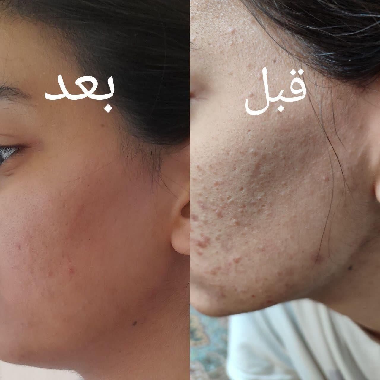 محصولات مراقبتی پوست و مو با ضمانت،ارسال رایگان|آرایشی، بهداشتی، درمانی|مشهد, الهیه|دیوار