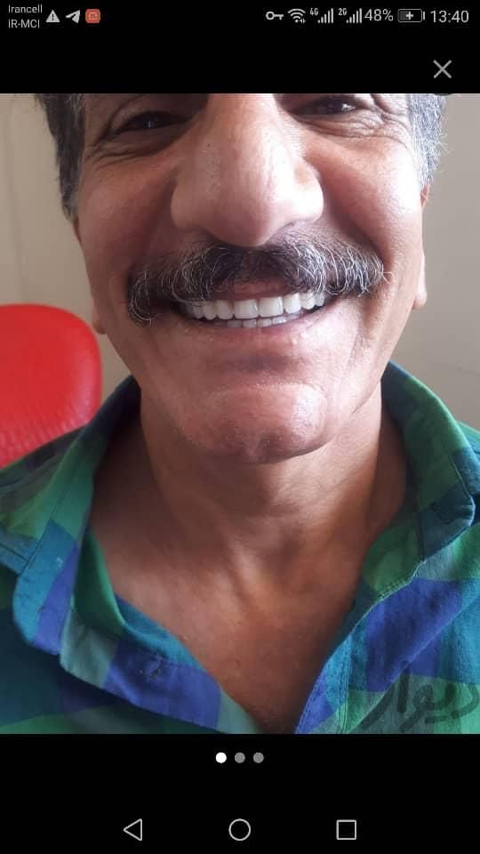 دندانسازی/دندان مصنوعی/دندان متحرک/لثه ژله ای|خدمات آرایشگری و زیبایی|شیراز, پانصد دستگاه (بلوار رحمت)|دیوار