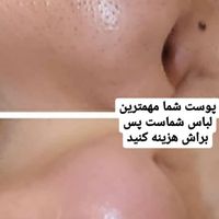 فشیال صورت و پاکسازی صورت|خدمات آرایشگری و زیبایی|قم, شهید بهشتی|دیوار