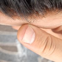 مرکز فروش انواع پروتز مو وارداتی اورجینال|آرایشی، بهداشتی، درمانی|تهران, کوی فردوس|دیوار