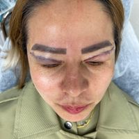ژل ‌بوتاکس ‌بلفارو  فیلربادی آنزیم لیزر و نخ مزو|خدمات آرایشگری و زیبایی|کرج, گوهردشت|دیوار